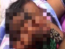 神の生まれ変わりか!? 「ガネーシャの妻」と名付けられた奇形の赤ん坊=インド