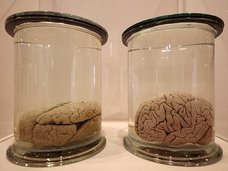 【哲学】現実は「水槽の中の脳」が見ている夢だった! デカルトとカントも唱えた「シミュレーション仮説」の真実性とは?