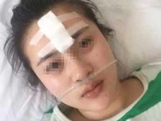 「整形しないなら、出勤するな!」ママに整形を強要された挙げ句、大失敗! 中国19歳ホステスの悲劇