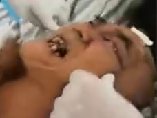 【閲覧注意】両目にウジ虫がギッシリ詰まった男、地獄の開眼!