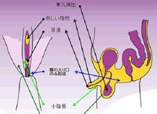 【やや閲覧注意】実録!タイの性器事情 ニューハーフになるためのすべて