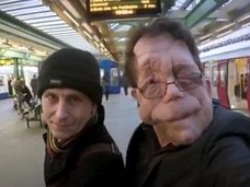 【閲覧注意】双子の片方はエレファントマン ― アダムとニールの苦しくて強い人生=イギリス