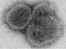 未だ解明されない謎の激ヤバな最凶ウイルス10! 出血、発熱、死亡…アウトブレイクで人類滅亡!?