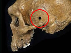 30万年前のローデシア人の頭蓋骨に明らかな“銃痕”! スナイパーにこめかみを撃ち抜かれた可能性も!?