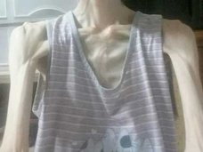 【美容整形の闇】「まるでミイラ……」頬骨削り手術の副作用で、体重が27kgに