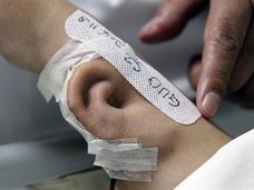 失った耳を腕で培養して再建→側頭部にくっつけて完成! 最先端外科手術の様子がキモスゴい=中国