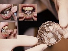 元歯科医が本気で開発した「フェラチオ専用マウスピース」が超話題! ペニスに完璧フィット、圧倒的な快感を約束!