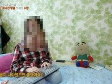 垂れた皮膚で顔が覆われた全盲の“エレファントマン”女性に、1億円の募金集まる