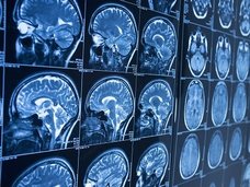 【ガチ】20年以上ホルマリン漬けだった脳が蘇る! 脳死と意識の定義完全に覆るか(カナダ・米大学研究)