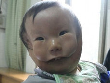 【閲覧注意】顔の上にもう1つ顔 ― “仮面少年”と呼ばれる少年の誕生に母は…!?