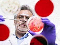 【衝撃生物学】微生物に記憶力があることが判明!しかし“ある理由”から記憶喪失に…!