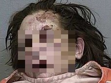 人間、やめますか? ― ハードドラッグにハマった女性たちの顔面激劣化(モンスター化)がヤバい!