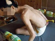 開院前からの計画的犯行か? 障害者や認知症患者を奴隷扱いする「ブラック病院」にメス