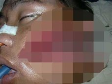 【超・閲覧注意】恐怖の「人肉グラデーション」 ― ロシアのゴアバンドが惚れこんだ痛々しすぎる死体写真