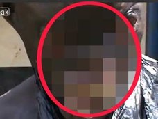 【閲覧注意】“美しすぎる息子”に嫉妬した継母、息子の顔を完全崩壊! 醜いバケモノになったオニャンゴの惨すぎる姿