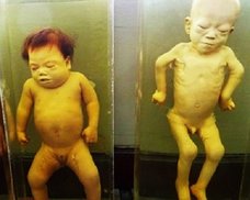 【閲覧注意】子どもを喰いまくった男のミイラ、単眼の赤ん坊、シャム双生児…タイの死体博物館「シリラート」