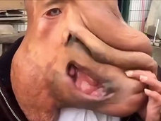 【閲覧注意・奇病】体の半分が顔になった男 ― 絶対絶望のエレファントマンの悲劇=中国