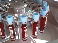 【衝撃】やはり「血液型が人の運命を左右する」ことが科学的に判明! B型の評価は死にたくなるレベル