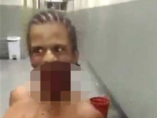 【閲覧注意・精神】顔を撃たれた男が病院でゲラゲラ笑いながら「エビ反りダンス」=ブラジル