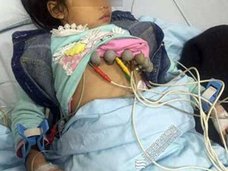 園児53名が体調不良に……中国の保育園で、給食への「劇薬混入テロ」が続発中