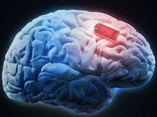 「4年以内に脳にコンピュータを埋める。他者の概念が直接ダウンロードでき、“テレパシー”が新言語になる」イーロン・マスクが断言!