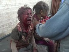 【閲覧注意】正義とは何か!? 「イスラム国」視点で見る米軍の空爆 ― 子どもの顔面は焦げ、血と粉塵まみれに…=イラク