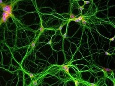 【ガチ科学】消したいトラウマ記憶を“切り抜く”技術が開発される! 一生思い出すことは不可能、洗脳に悪用される可能性も=アメリカ