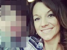 【閲覧注意・奇病】1人で2つの顔を持つ13歳の少年 ― 顔がパックリ分断、頭蓋骨も変形=米国・顔面重複奇形