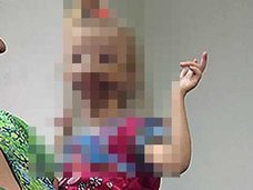 【閲覧注意・奇形】唇がくり抜かれた少女ダリア ー 口の中が剥き出しで生まれて =ロシア