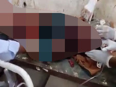 【閲覧注意】狂気の血まみれ「即席手術」映像に戦慄! インドの地方病院で行われる超劣悪医療の実態!