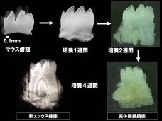 もうすぐインプラント終焉、失った歯を培養して完全再生できるようになる! 大変革期に突入した歯科医療の最前線を徹底解説
