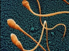 【警告】22年後に世界から精子が尽きることが判明、人類滅亡へ! 研究者「爆速で精子が減少中」(最新研究)
