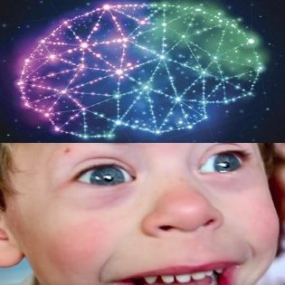 出会う人すべてを愛しまくる奇病「ウィリアムズ症候群」! DNAが人懐こい犬と類似、人類の最新進化系か!?