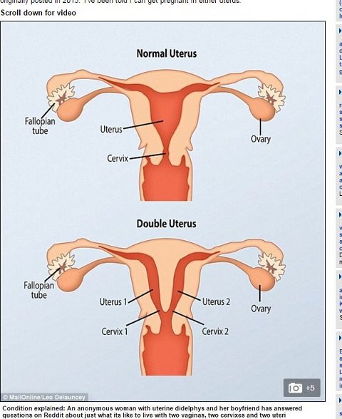 uterusdidelphys1.JPG