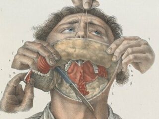 【閲覧注意】19世紀の外科手術が怖すぎる、痛すぎる、残酷すぎる！