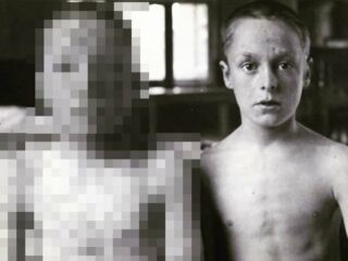 【閲覧注意】あの有名な天然痘少年2人の「鳥肌級」衝撃写真、フェイクではなく本物だった！