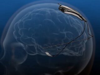 「犯罪者の脳を手術すべき」vs「犯罪者と我々の脳は同じ」