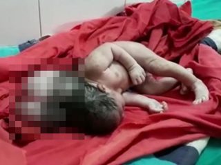 【閲覧注意】インドで“3つの頭”を持つ赤ん坊が誕生！ 重篤すぎる先天異常の原因とは…