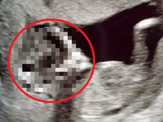 16歳少女がエイリアンベイビーを妊娠か!? グレイ型の胎児がエコー写真にくっきり、「心当たりが…」衝撃展開！