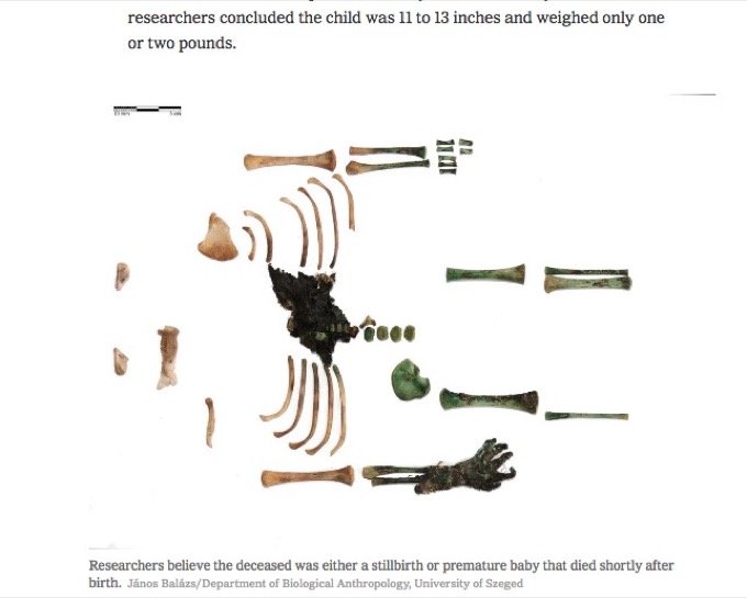 150年前の「緑色の小さな手のミイラ」の謎がついに解明される! 奇跡の愛情が時空を超えて判明!?(最新研究)の画像2