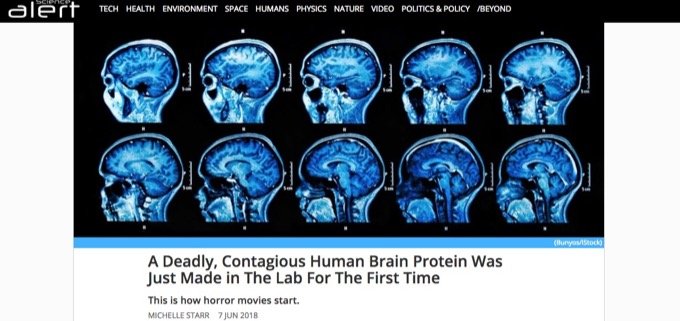 人間にも伝染する「人工プリオン」が開発される！ 脳がスポンジになって死ぬ…狂牛病の恐怖再び!? の画像1