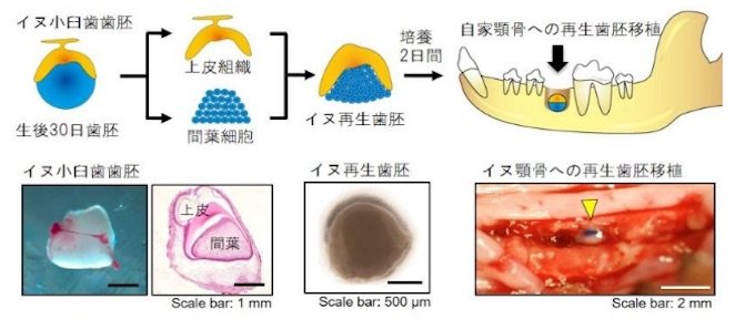 もうすぐインプラント終焉、失った歯を培養して完全再生できるようになる? 大変革期に突入した歯科医療の最前線を徹底解説の画像2