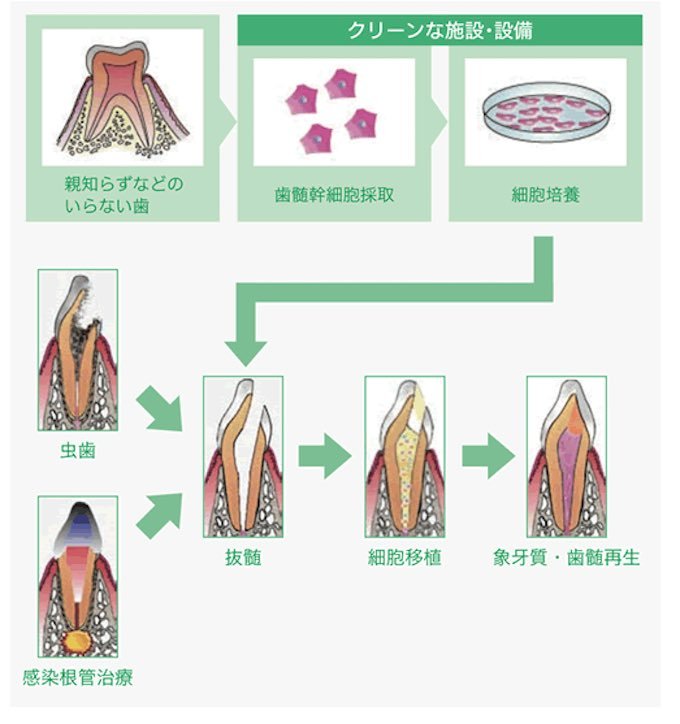 もうすぐインプラント終焉、失った歯を培養して完全再生できるようになる? 大変革期に突入した歯科医療の最前線を徹底解説の画像3