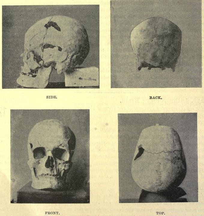 古代エジプトのファラオは正真正銘の巨人だったことが判明!! ピラミッド建造は「巨人の体格に合わせた」可能性の画像2