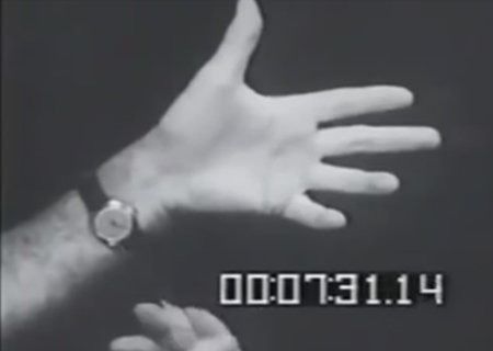 1604_lobotomy_01.jpg