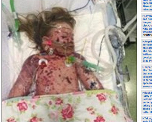 1604_meningitis_02.jpg
