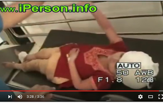 【超・閲覧注意】脳からバレーボールが出てきた女、無事生き延びるの画像4