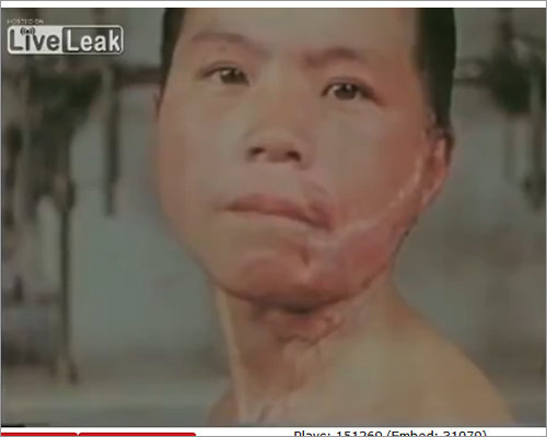 【原爆の日】被爆者の本当の惨状がわかるカラー写真・映像! 皮膚は溶け、体が曲がる症状も…絶対に目を背けてはいけない!の画像4