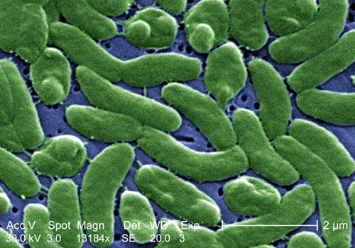 【閲覧注意】顔面半分を喪失、頭蓋骨まる見えに! 人食いバクテリアがもたらす「壊死性筋膜炎」の恐怖の画像1