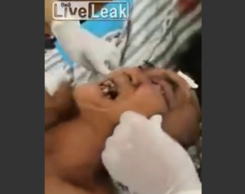 【閲覧注意】両目にウジ虫がギッシリ詰まった男、地獄の開眼!の画像1